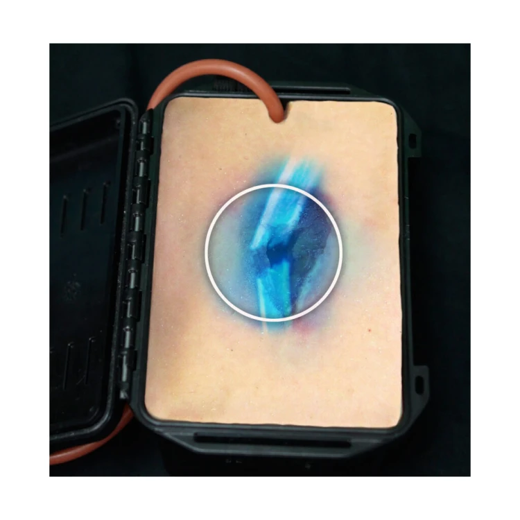 Trenazer-tamowania-krwotoku-rana-odlamkowa-Shrapnel-Wound-in-a-Box®-3-1024x1024.jpg